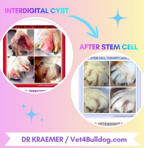 interdigital cyst treated with stem cell therapy